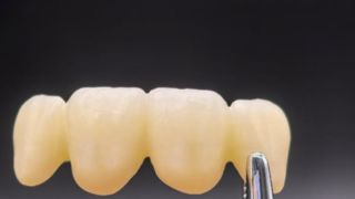 Audental 4D ماستر زركونيا