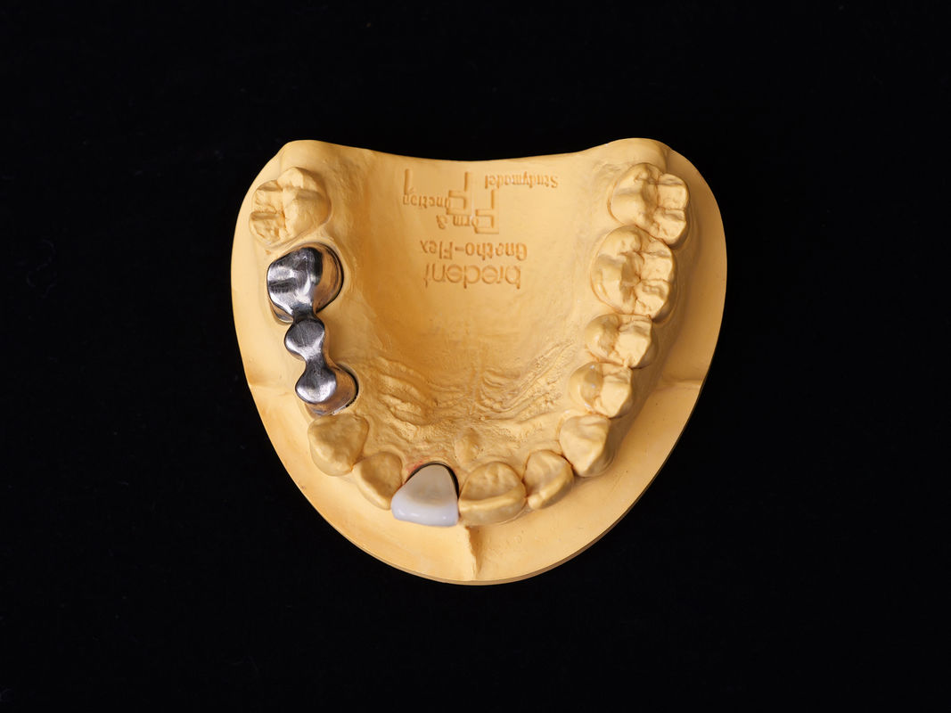 Audental 04 سبيكة النبيلة الفضة-البالاديوم سبيكة البورسلين البيضاء Pd53.3% لاستعادة الأسنان طويلة الأمد