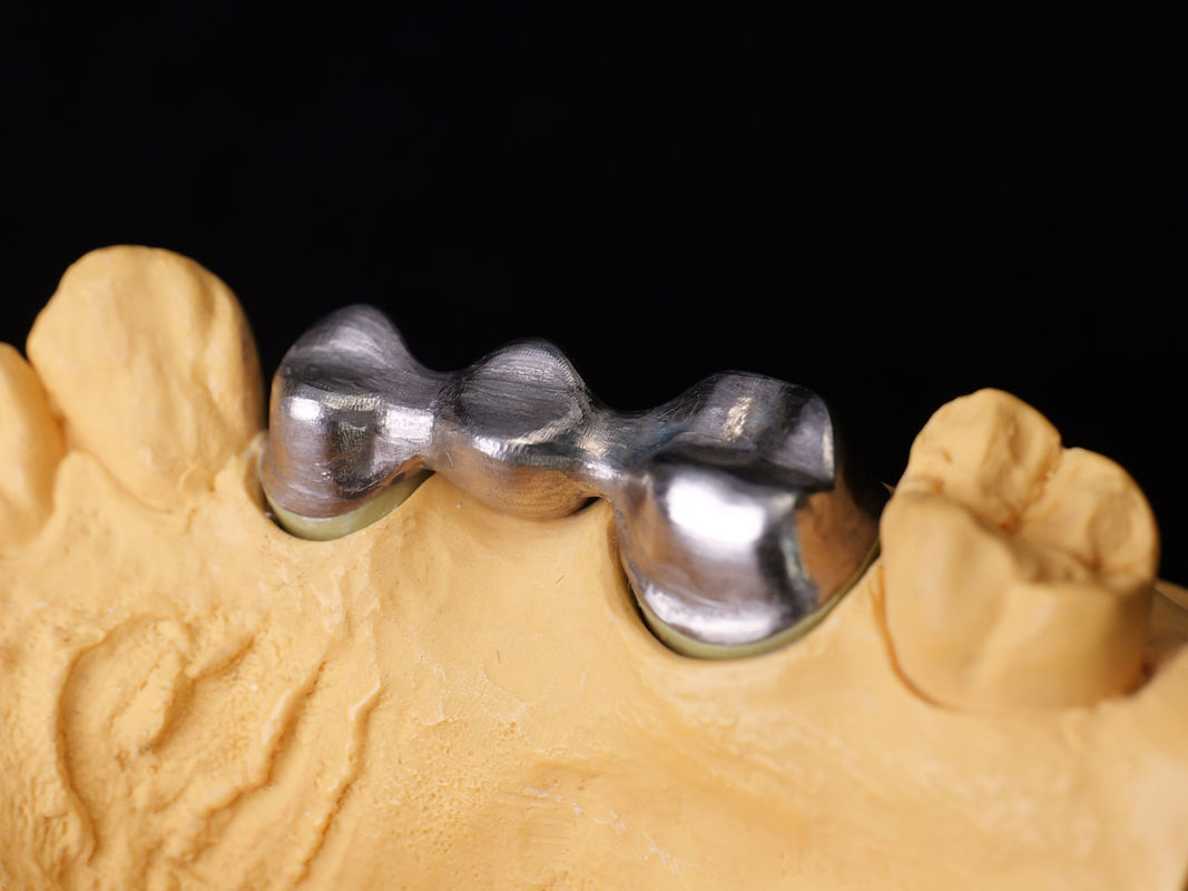 Audental 04 سبيكة النبيلة الفضة-البالاديوم سبيكة البورسلين البيضاء Pd53.3% لاستعادة الأسنان طويلة الأمد